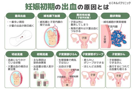 胎盤形成出血|妊娠の初期出血とは？知っておきたい5つの特徴と注。